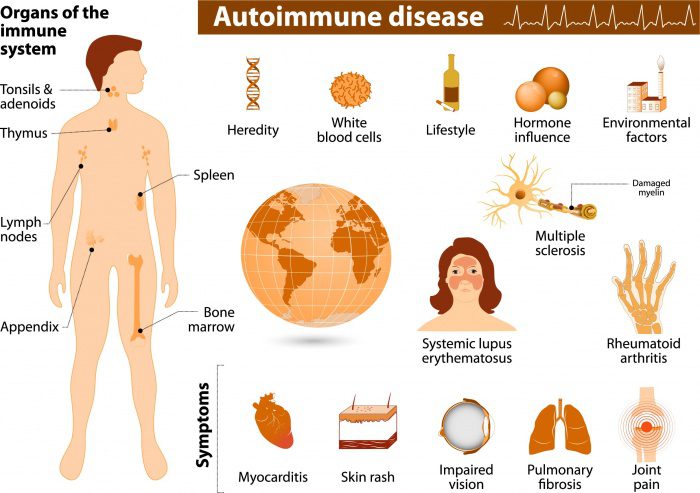 A diagram of the symptoms and treatment for autoimmune disease.